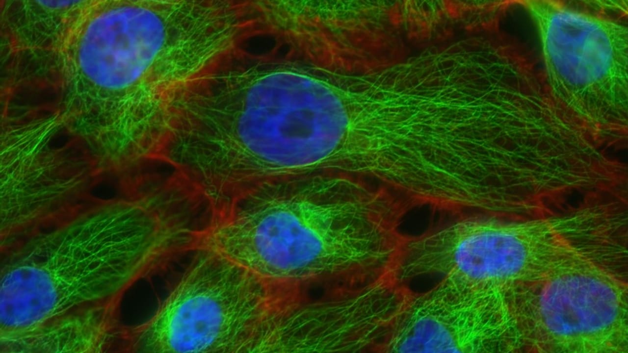 An Achilles Heel Found in Cancer's Rogue DNA