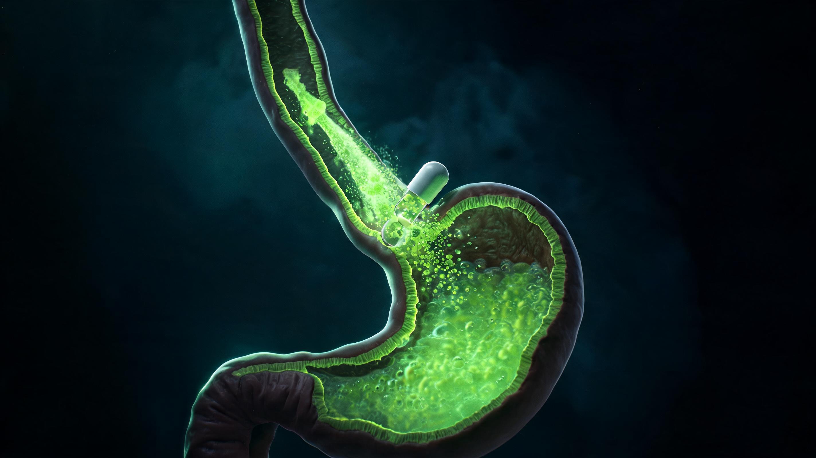 Do Proton Pump Inhibitors Really Work for Acid Reflux