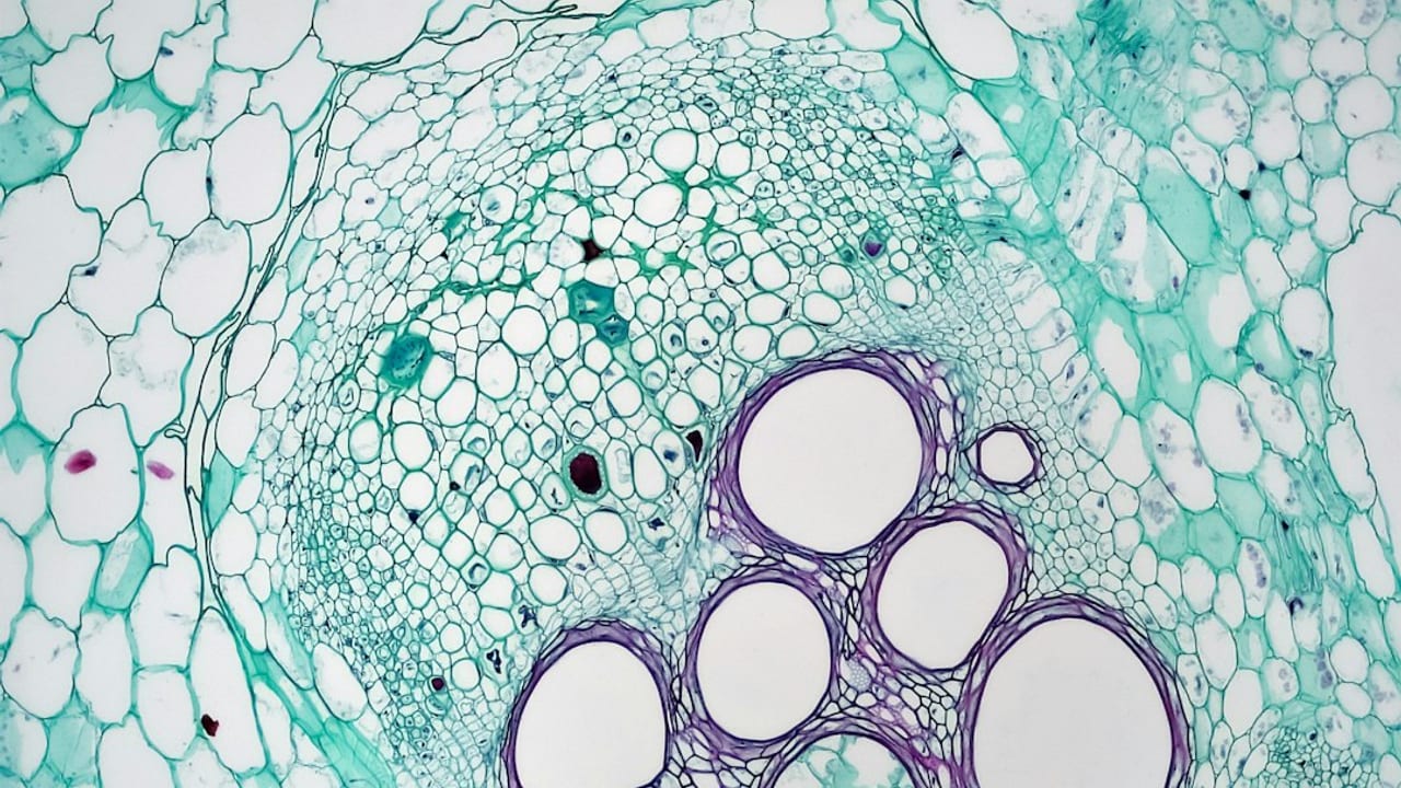 Phthalate alarm in the ovary: single-cell map shows support cells are hit too